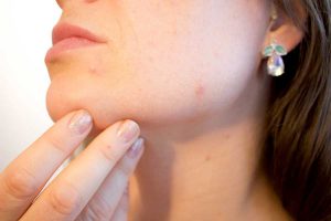 AU SECOURS, MA PEAU NE SUPPORTE PLUS RIEN !
