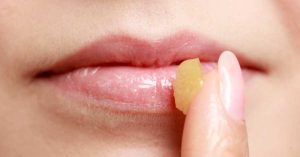 Lèvres gercées en hiver : 6 gestes essentiels pour les adoucir et les protéger 6 GESTES ANTI-LÈVRES GERCÉES