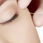ACIDE HYALURONIQUE, BOTOX® OU COLLAGÈNE : COMMENT CHOISIR SON INJECTION ?