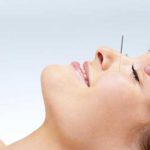 ACULIFTING, LE LIFTING SANS CHIRURGIE : ON TESTE ?