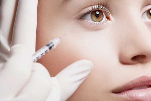 LES DIFFÉRENTS TYPES DE FILLERS ET LEURS EFFETS