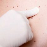 DE L’IMPORTANCE DE L’AUTO EXAMEN DES GRAINS DE BEAUTÉ