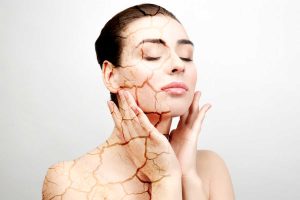 PEAU SÈCHE, RÉACTIVE, COMMENT L’APAISER ?