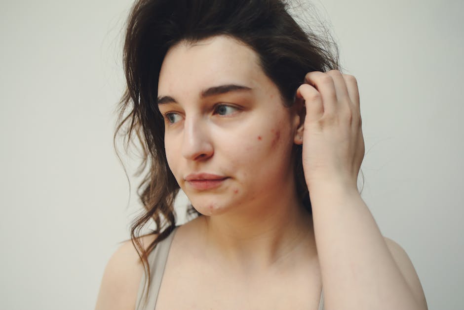 Peau stressée : comprendre les effets du stress sur votre peau et comment y remédier close up skin imperfections dry skin stress acne face woman