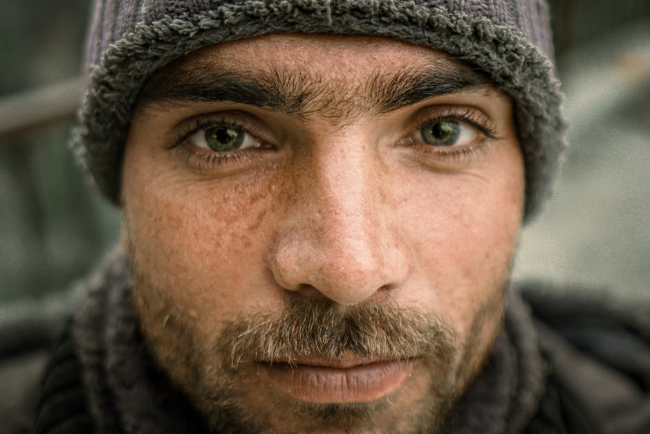 Chauffage et peau sèche : comment protéger son visage en hiver close up dry skin face winter cold weather